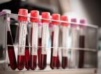 Německá rozvědka naznačuje, že COVID-19 pravděpodobně unikl z čínské laboratoře